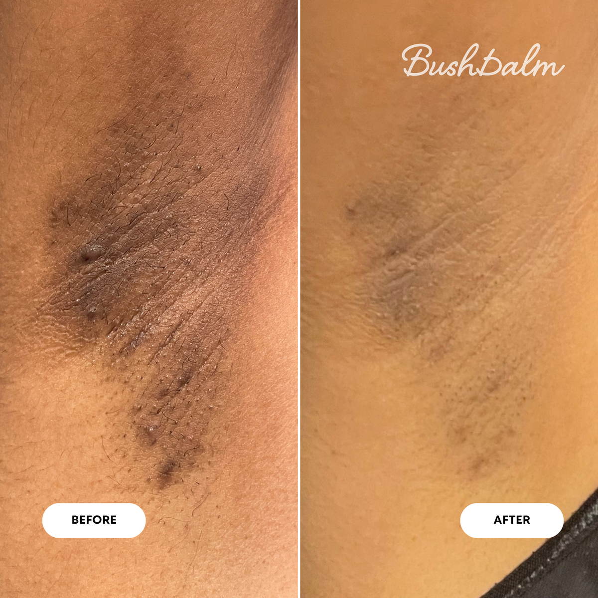 2-Step Dark Spot Routine - Bermuda