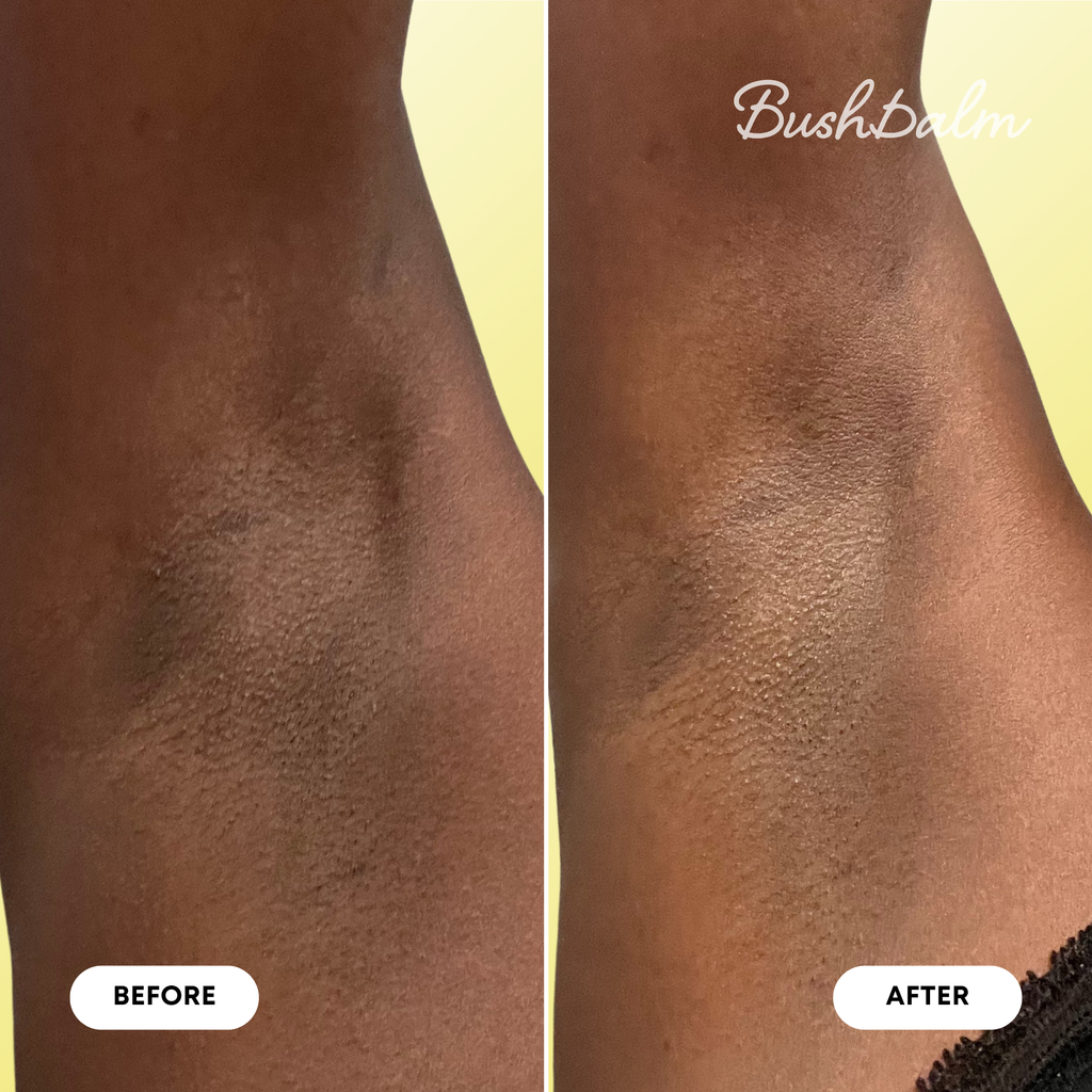 Dark Spot Oil - Bermuda