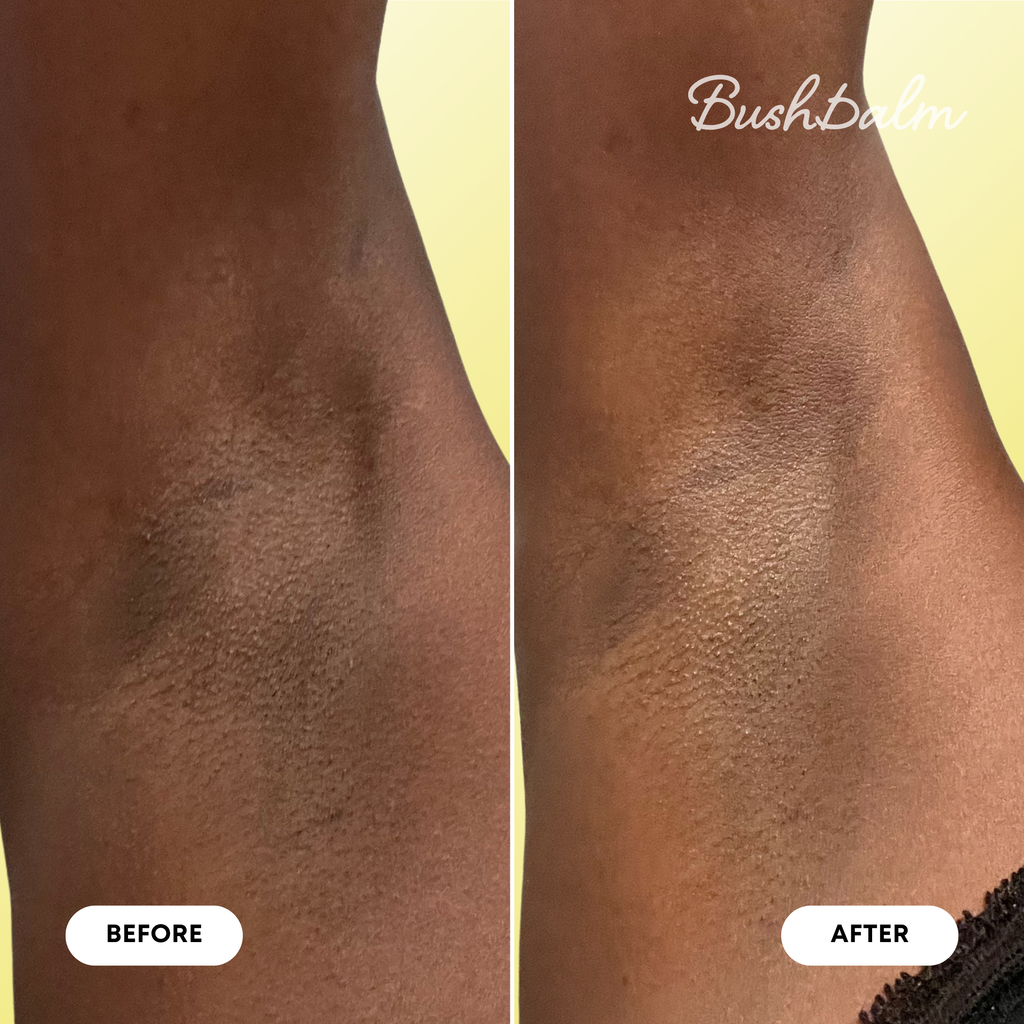 Mini Dark Spot Oil - Bermuda