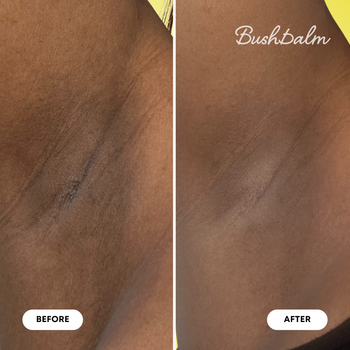 Dark Spot Exfoliating Scrub - Bermuda