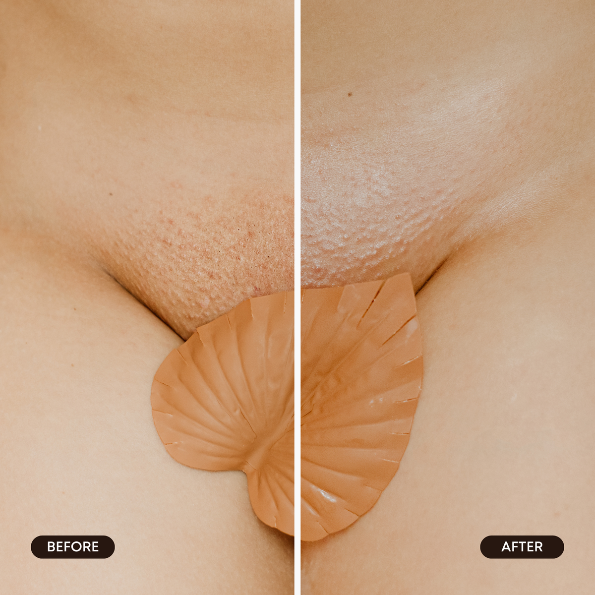 Hydrogel Vajacial Triangle Mask