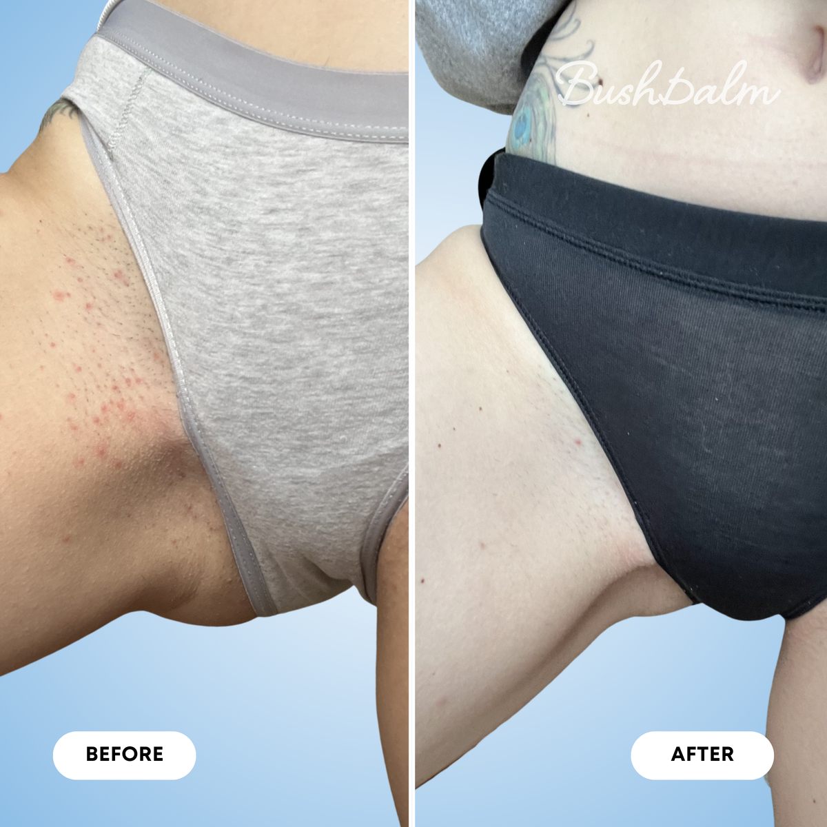 Ingrown Hair Exfoliating Scrub - Nude