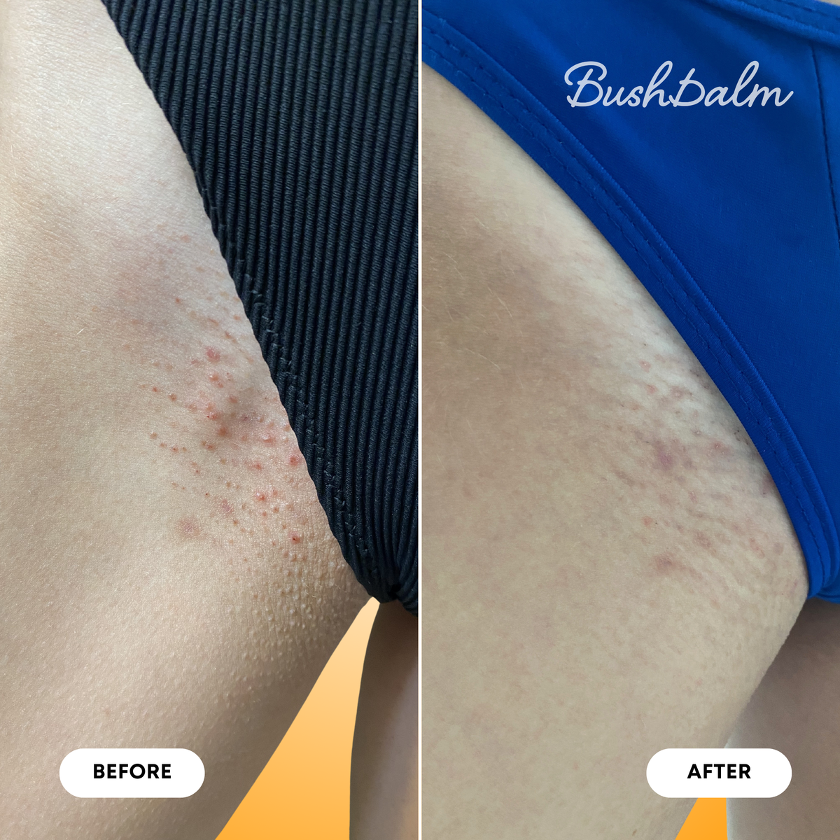 2-Step Ingrown Hair Routine - Vanilla Tangerine
