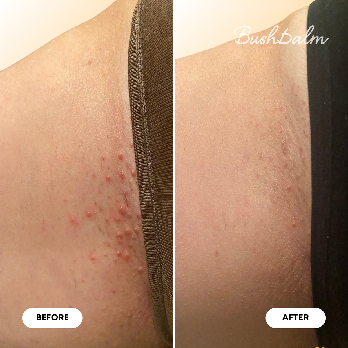 Mini Ingrown Hair Oil - Vanilla Tangerine