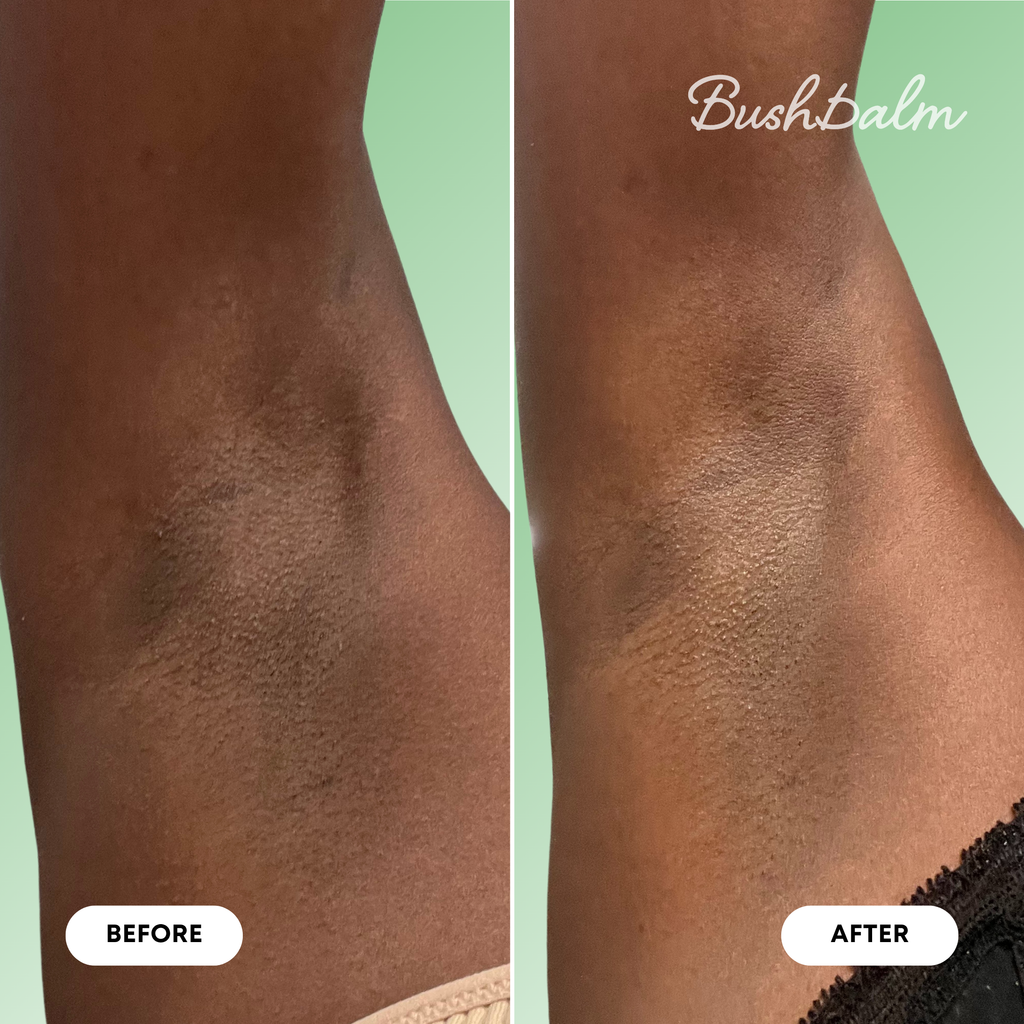 Wild Mint & Lemon Dark Spot Oil