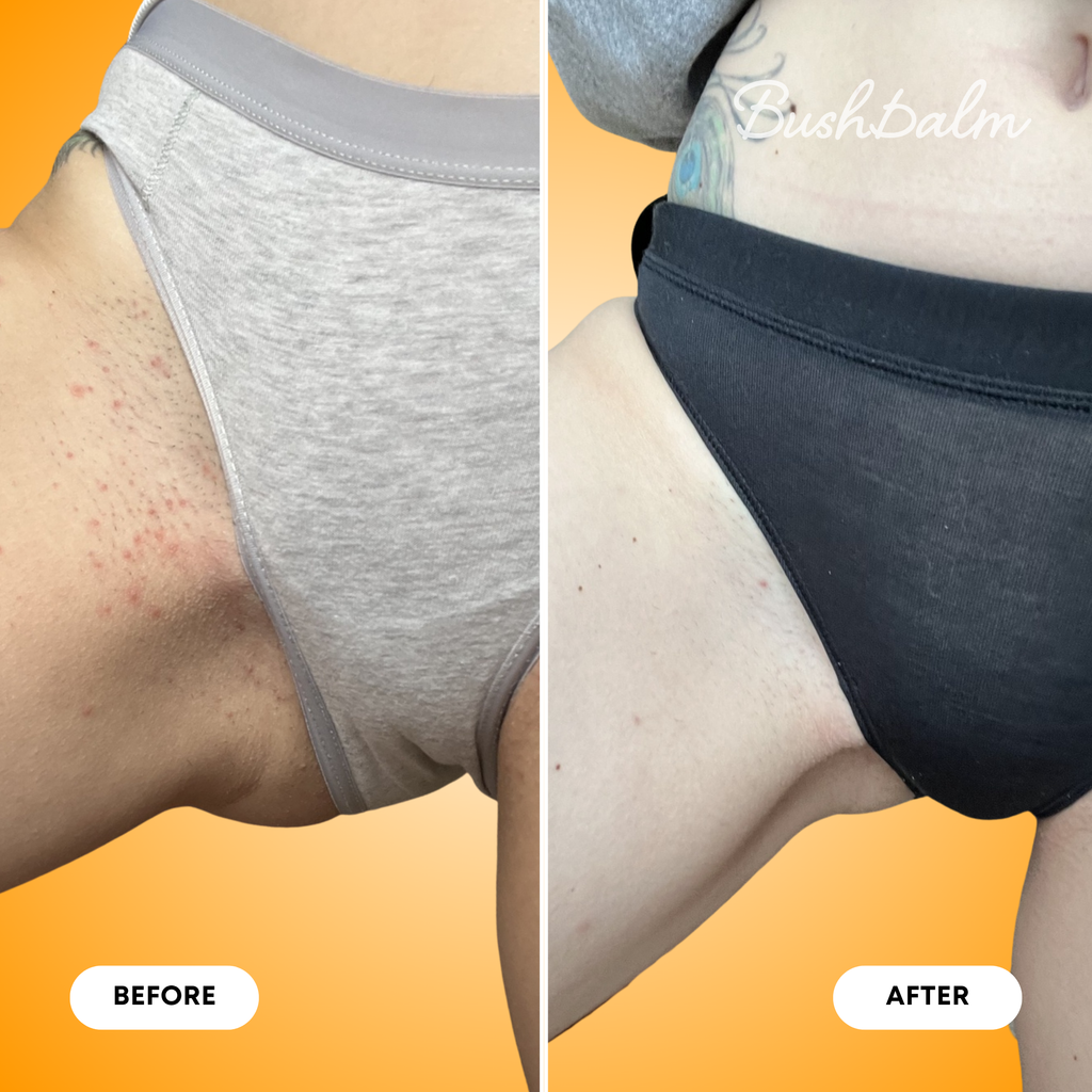 Ingrown Hair Exfoliating Scrub - Vanilla Tangerine