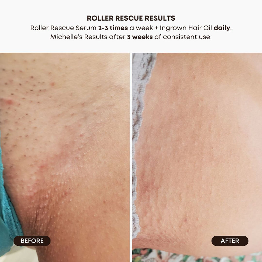 Smooth & Clear Bundle - Watermelon Sugar