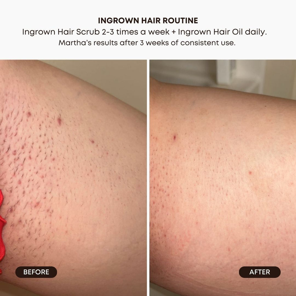 Smooth & Clear Bundle - Watermelon Sugar