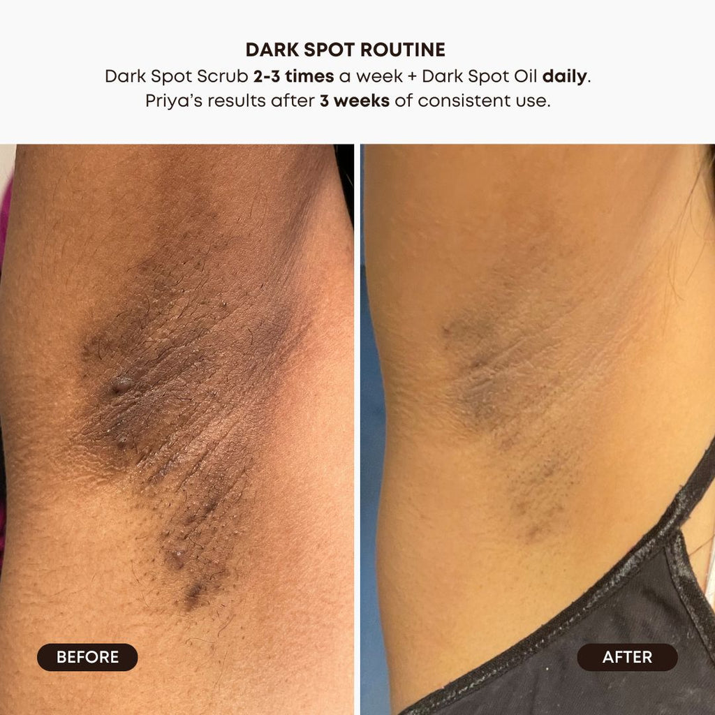 Dark Spot 2 Step Routine - Lavender Lemon
