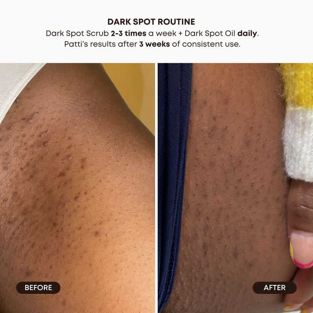 Dark Spot 2 Step Routine - Lavender Lemon